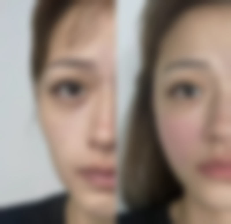 成都做面部轮廓好的医生:专精成就美丽