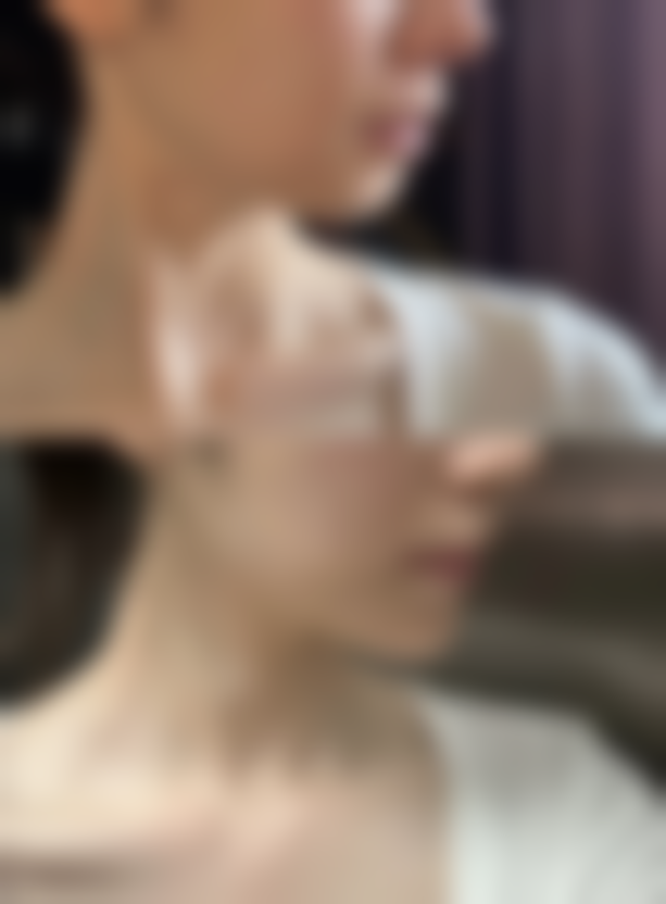 成都整形脸型轮廓最好的医院是哪家？这几家口碑超棒技术靠谱，闭眼冲！首推汉密尔顿+娇点，下颌角颧骨重塑技术封神！