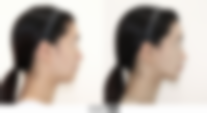 怎么判断我是否适合阴道紧缩术项目?满足这些条件可考虑