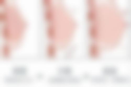 深圳艺星医疗美容医院收费贵吗？价目表揭秘，多项项目价格亲民！