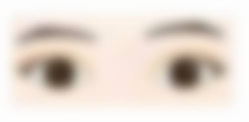 怎么判断我是否适合双眼皮宽改窄修复项目?