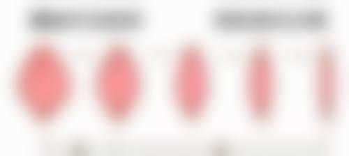 项目价格对深圳乔雅登玻尿酸填充的影响