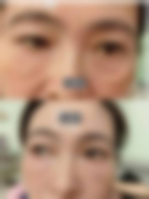 3. 北京童颜塑美——高性价比注射标杆,午餐美容优选