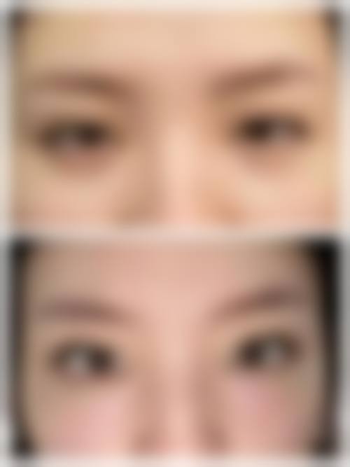 北京轻医美整形医院排名前十，排名前三的是哪几家医院呢？|润颜、薇拉、童颜塑美口碑爆棚，朋友推荐不踩坑！