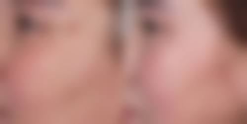 五、祛斑项目热门问题解答