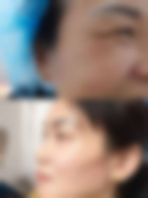 杭州天鑫医美医院价格详情:透明合理性价比高