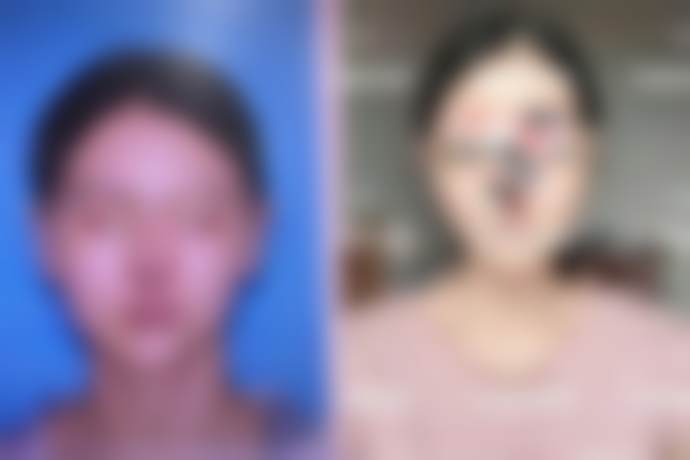 三、赵轩济医生技术水平高吗？技术优势有哪些