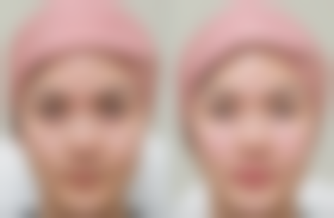 大连爱德丽格整形医院：特色项目大揭秘！