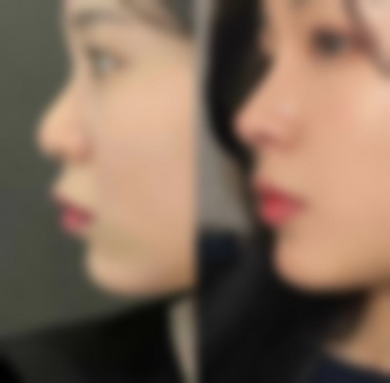 大连爱德丽格刘志刚医生介绍：眼修复技术的领跑人