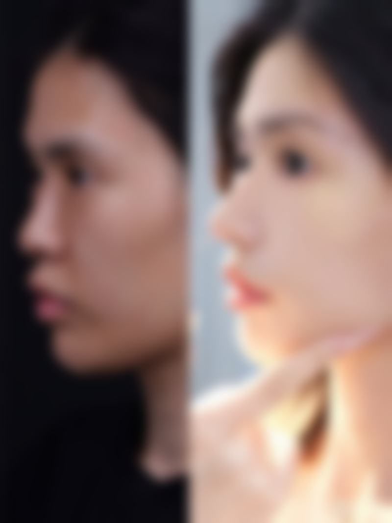 深圳艺星医疗美容医院正规吗？实力如何？