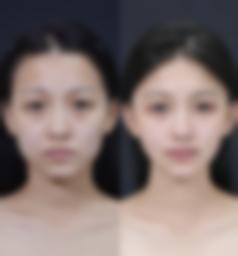 谢金华医生技术水平高