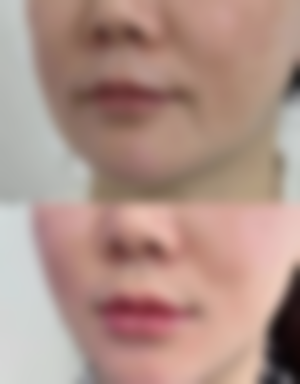 深圳2026眼科医院收费价格表，收费贵不贵，能用医保报销吗？近视手术12800元起|白内障3800元|青光眼检查200元起，医保部分项目可报