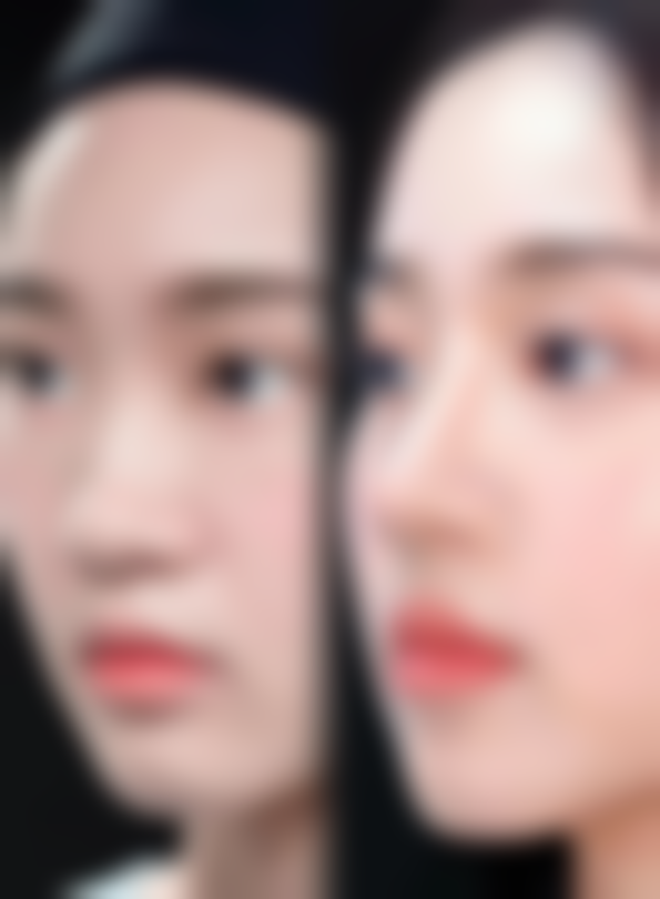 深圳艺星医疗美容医院收费的优势