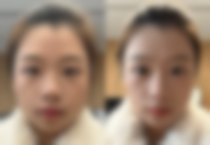 3. 上海南山医院美容外科(上海微创整形医生排名 TOP3)