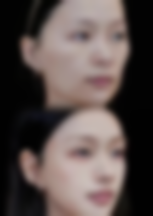 用香蕉牛奶燕麦自制美白除皱面膜是什么？通常在什么医学背景下被选择？