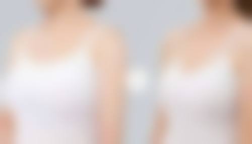 武汉五洲整形外科医院怎么样？正规5A资质，内窥镜丰胸和鼻修复技术口碑超好！