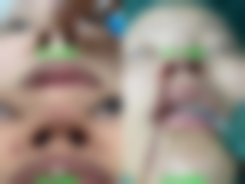 大连爱德丽格整形医院的手术成效如何？真实实例见证美丽蜕变