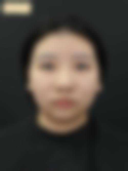 沈阳磨骨手术哪家医院好？这几家靠谱正规、医生技术厉害的医院值得了解