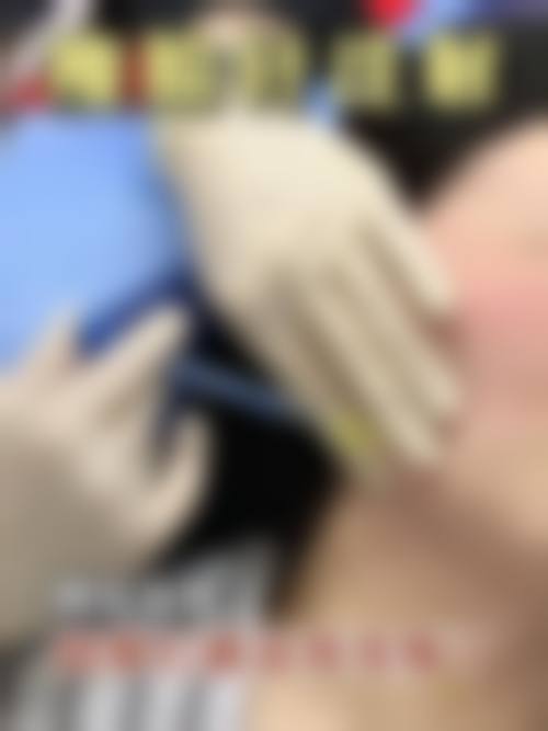沈阳医 大瘦脸针