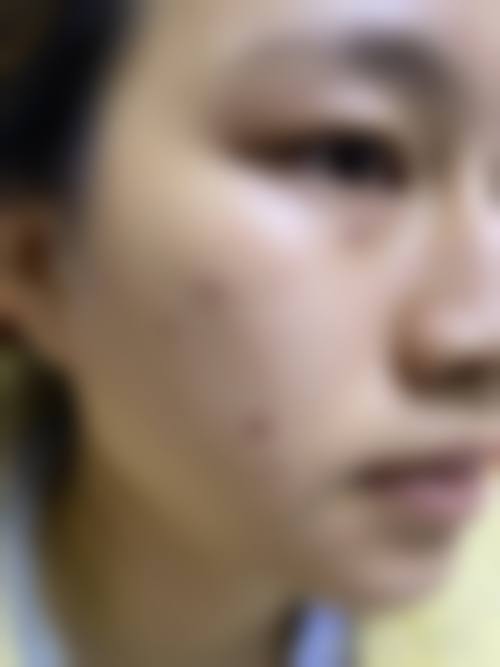 2. 脱毛过程中会特别疼吗？