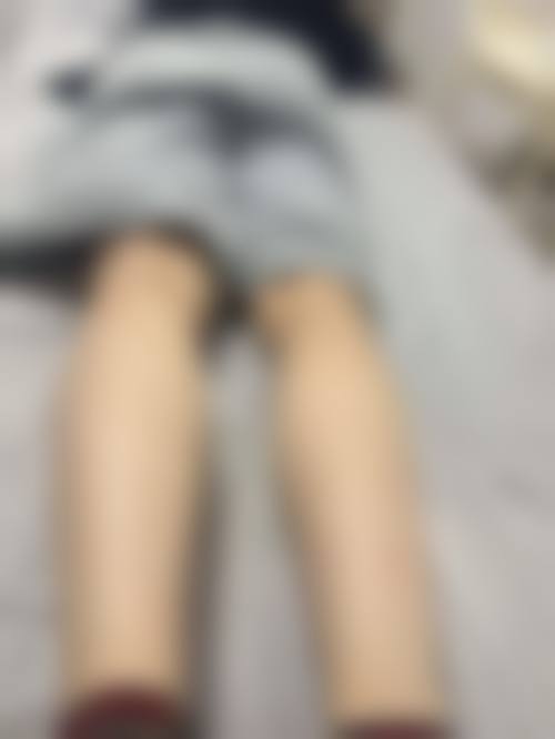 广州广美美雅高金玲医生技术水平高