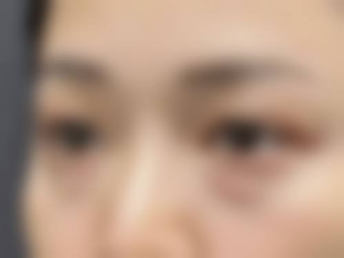 哪些使用场景下天然果蔬法、按摩法和眼霜护理的成效往往不理想