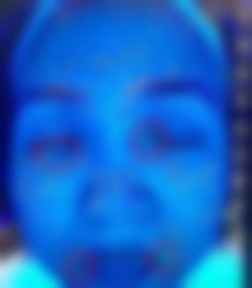 广州广美美雅高金玲医生口碑评价及反馈内容