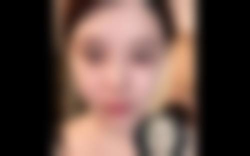 五、在实际操作中，打瘦脸针一周后吃消炎药更适合哪些人？