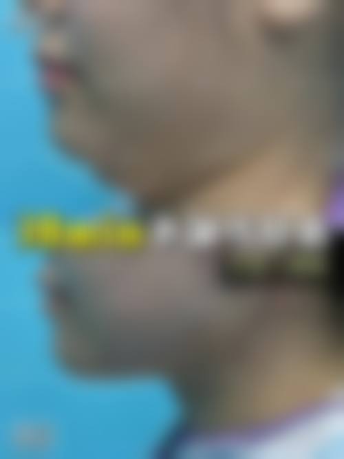 瘦脸针是什么?通常在什么医学背景下被选择?