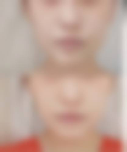 瘦脸针的价格区间及费用差异来源