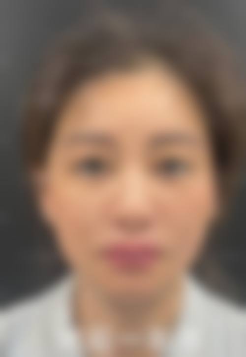 五、真实实例+透明价目：上海华美变得更美成效看得见，消费明明白白