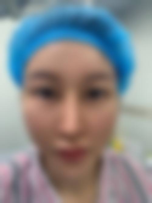 四、庞朝奇医生技术优势与操作流程