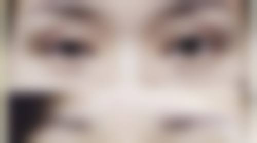 大连爱德丽格刘志刚医生介绍：眼修复领域的领军人物