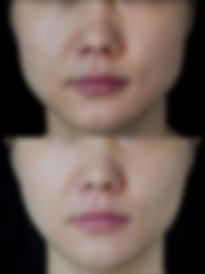 深圳富华医疗美容医院预约挂号要注意什么?避坑指南请收好!