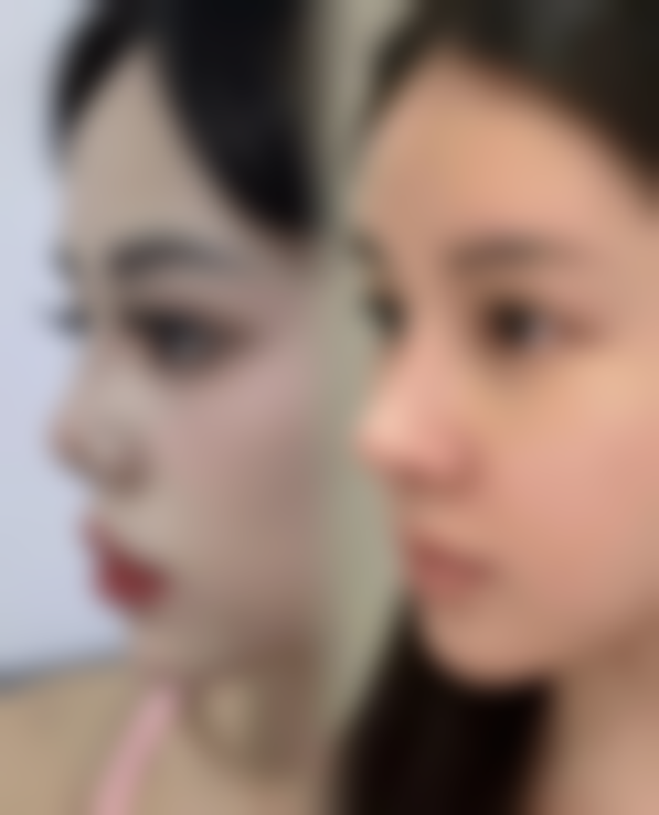 上海华美医疗美容医院医生技术如何？骨干医生团队与实例说话！