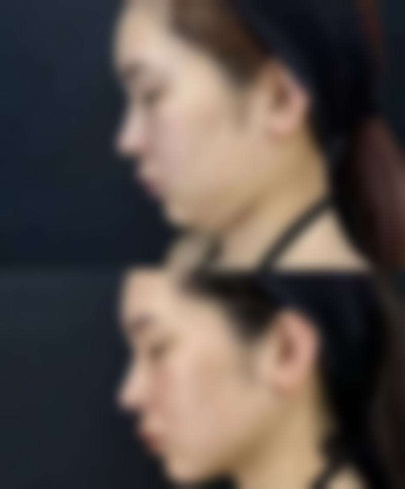 为什么雅诗兰黛白金眼霜的前后对比差异会非常明显