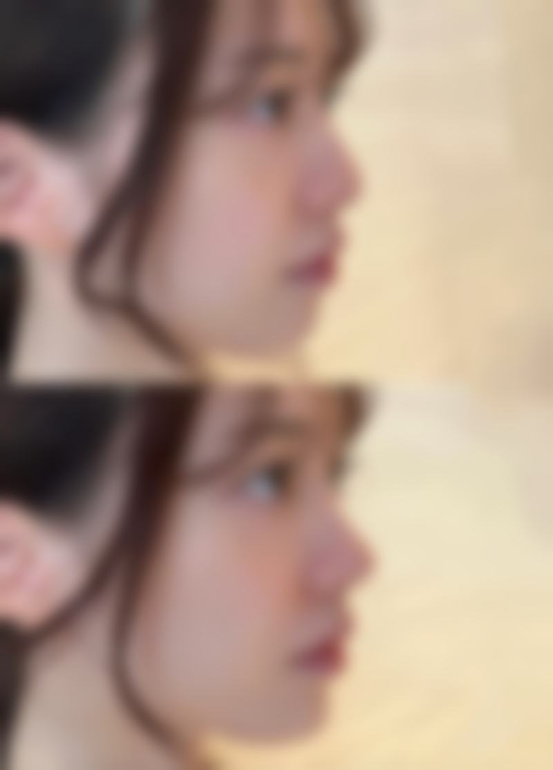 杭州纹眉毛哪里技术好？盘点正规靠谱的医美机构与口碑医生推荐