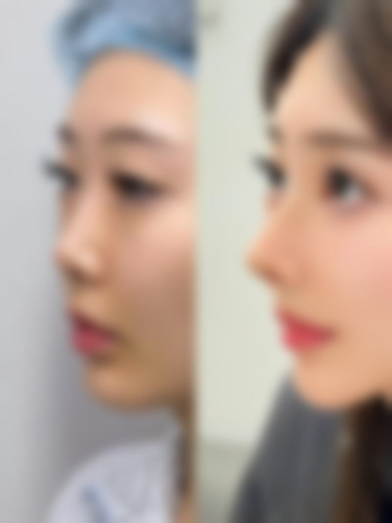 天鑫医美医生团队靠谱吗？持证上岗+多年经验，技术在线更放心！