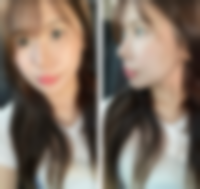 大连爱德丽格医疗美容门诊部是渠道医院吗？不是！它是正规靠谱医院口碑还挺好！刘志刚团队眼修复技术出圈，动态重睑修复术获金刀奖