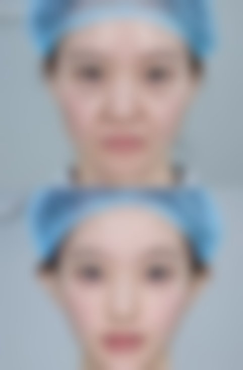 天鑫医美操作规范吗？标准化流程+术后跟踪，全程护航变得更美路！