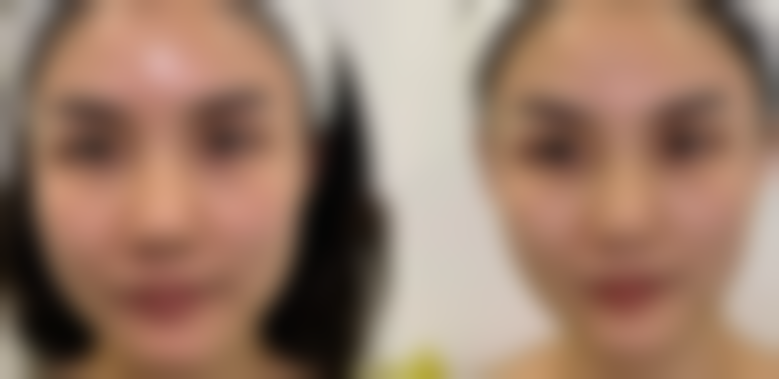 成都做拇外翻好的医院排名，排名靠前的医院是公立还是私立呢？ 