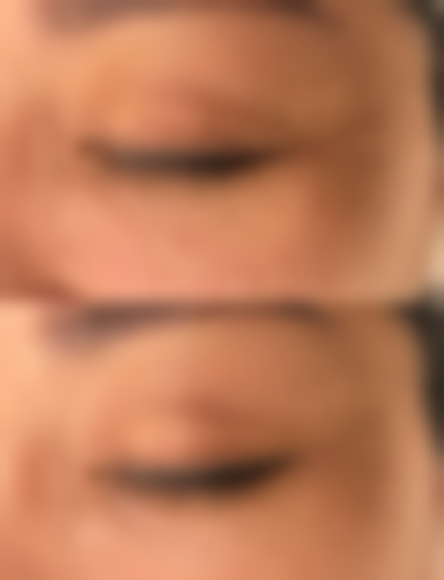 哪些使用场景下雅诗兰黛白金眼霜的成效往往不理想