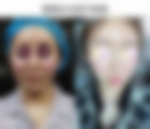 七、费用明晰：广州医 科 大学附属第一医院常见项目收费参考