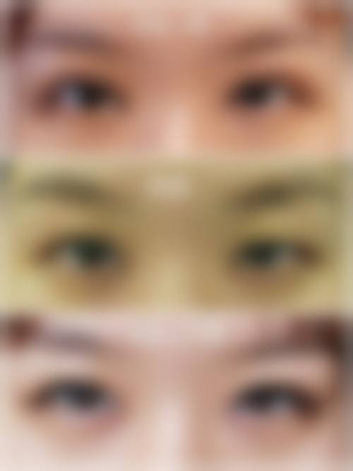 中老年客群也信赖！连天美修复项目为何口碑出圈？