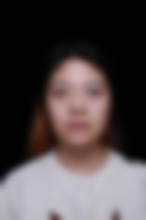 深圳人民医院整形科预约留手机号会被泄露吗?医院隐私保护措施揭秘