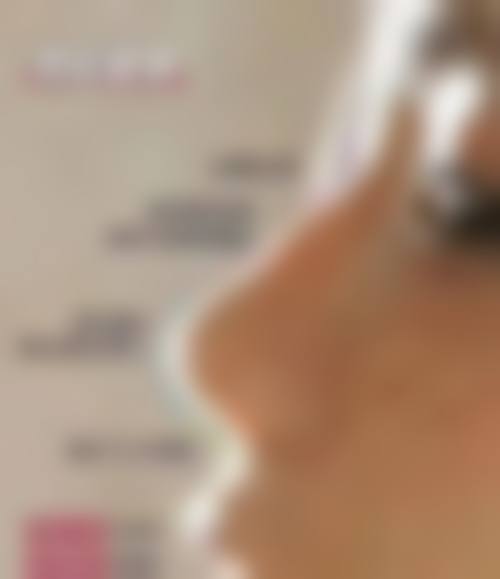 价格透明度大揭秘：从双眼皮到隆鼻，多少钱才不算被坑？