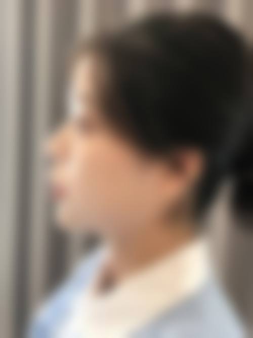 杭州连天美医疗美容医院口碑怎么样？正规资质、显著效果与贴心服务，值得信赖！ 