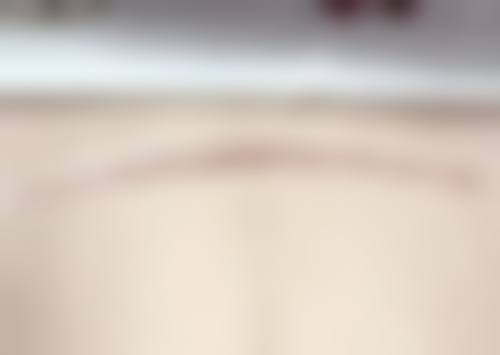 深圳富华医美医院口碑好的原因是什么？