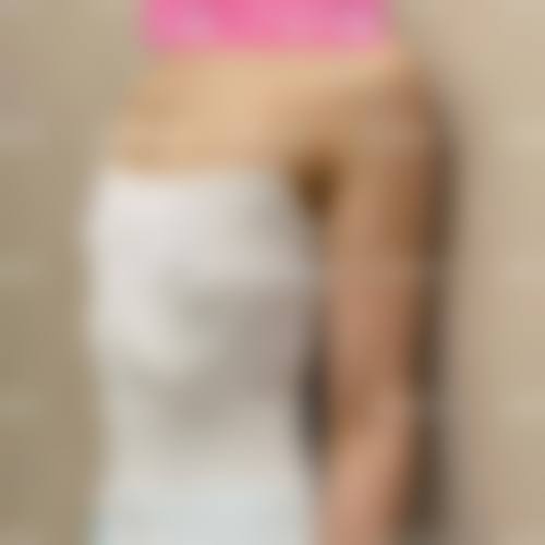 隆胸材质对哺乳影响大吗是什么?通常在什么医学背景下被选择?