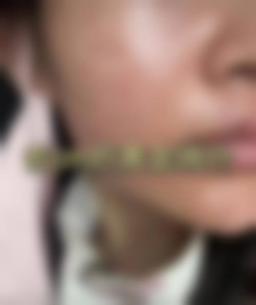 杭州做微针好一点的医院